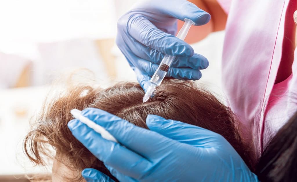 Hair Growth Injections